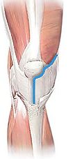 What muscles are cut using the muscle sparing total knee replacement Subvastus Approach