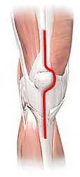 What muscles are cut during a traditional total knee replacement